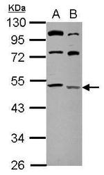 LCLAT1 Polyclonal Antibody