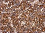 MMAB Polyclonal Antibody