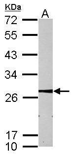 MMAB Antibody in Western Blot (WB)