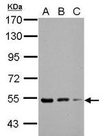KBTBD4 Polyclonal Antibody