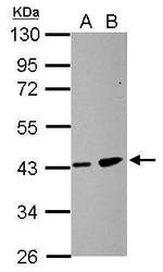 ZDHHC11 Antibody in Western Blot (WB)