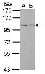 PHF17 Antibody in Western Blot (WB)
