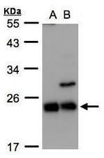 CBF beta Polyclonal Antibody