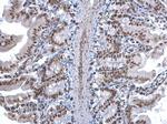 U2AF1 Antibody in Immunohistochemistry (Paraffin) (IHC (P))