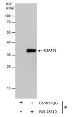 U2AF1 Antibody in Immunoprecipitation (IP)