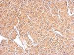 TSPAN3 Antibody in Immunohistochemistry (Paraffin) (IHC (P))