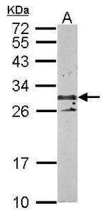 TSPAN3 Antibody in Western Blot (WB)