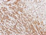 CLPH Antibody in Immunohistochemistry (Paraffin) (IHC (P))