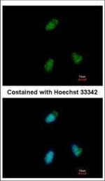 CLUAP1 Polyclonal Antibody