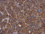 TXNDC5 Polyclonal Antibody