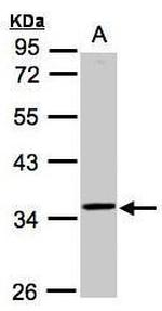 RG9MTD3 Antibody in Western Blot (WB)