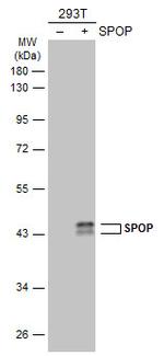 SPOP Polyclonal Antibody