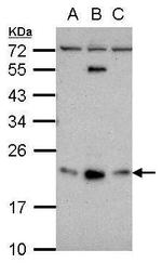 GLIPR1L1 Polyclonal Antibody