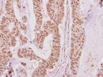 FAM111B Antibody in Immunohistochemistry (IHC)