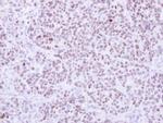 RCC2 Polyclonal Antibody