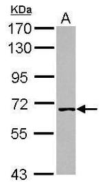 WHIP Polyclonal Antibody