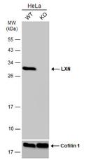 Latexin Antibody in Western Blot (WB)