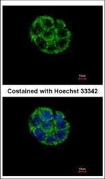 ASB5 Polyclonal Antibody