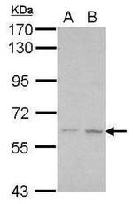KLHDC7B Antibody in Western Blot (WB)
