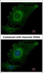 FBXO4 Polyclonal Antibody
