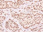 HENMT1 Antibody in Immunohistochemistry (Paraffin) (IHC (P))