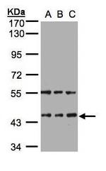HENMT1 Antibody in Western Blot (WB)