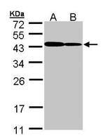 ART5 Antibody in Western Blot (WB)