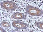 PARP11 Antibody in Immunohistochemistry (Paraffin) (IHC (P))