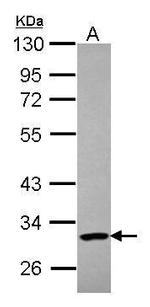 PARP11 Antibody in Western Blot (WB)