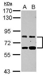 ZFP64 Antibody in Western Blot (WB)