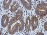 DCBLD2 Polyclonal Antibody