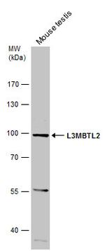 L3MBTL2 Polyclonal Antibody