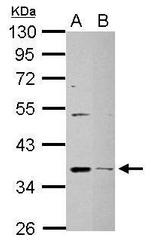 DHRS9 Polyclonal Antibody