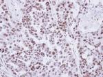 ZMAT3 Antibody in Immunohistochemistry (Paraffin) (IHC (P))