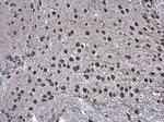 ZMAT3 Antibody in Immunohistochemistry (Paraffin) (IHC (P))