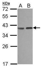 Carbonic Anhydrase VIII Antibody in Western Blot (WB)