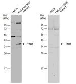GTF2B Antibody in Western Blot (WB)