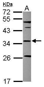 SCP2 Antibody in Western Blot (WB)