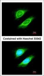 NCAPH Polyclonal Antibody