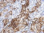 FGFR1 Antibody in Immunohistochemistry (Paraffin) (IHC (P))