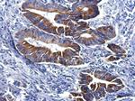 FGFR1 Antibody in Immunohistochemistry (Paraffin) (IHC (P))