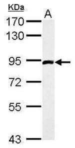 FGFR1 Antibody in Western Blot (WB)