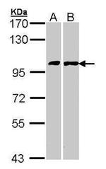 FGFR1 Antibody in Western Blot (WB)