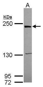 LRRK1 Polyclonal Antibody
