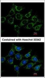 AGK Polyclonal Antibody