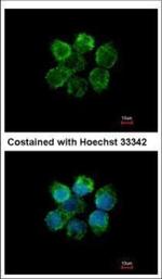 MST2 Polyclonal Antibody