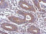PAPSS1 Antibody in Immunohistochemistry (Paraffin) (IHC (P))
