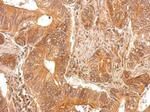 PAPSS1 Polyclonal Antibody