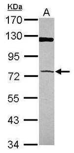 PAPSS1 Antibody in Western Blot (WB)