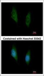 MEK6 Polyclonal Antibody